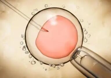 泰国试管婴儿移植囊胚儿子概率大吗