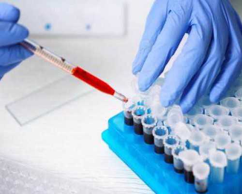 国内试管代怀医院,有做过精子分离生男孩的吗？成功率多少？